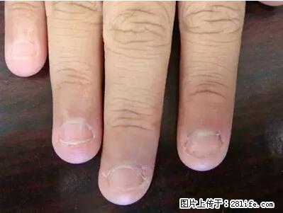 剪指甲、挖耳屎，这些日常小动作竟隐藏大危害！ - 张掖生活资讯 - 张掖28生活网 zhangye.28life.net